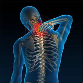 A lek eszköze az osteochondrosis - Osteochondrosis neck