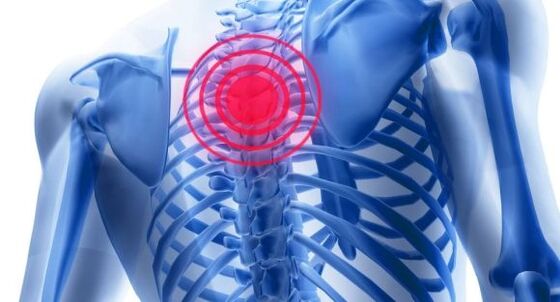 Treatment of osteochondrosis of the spine of the chest