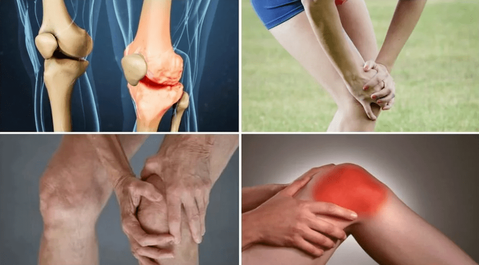 Symptoms of arthrosis