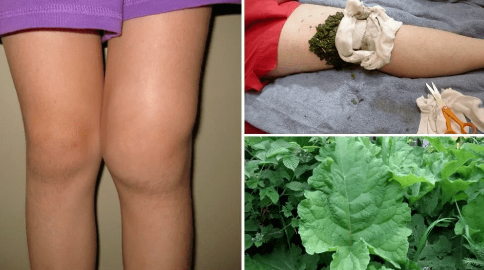 Treatment with popular methods